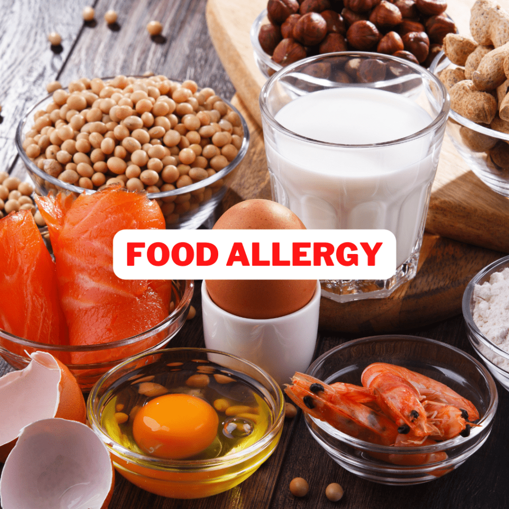 Image of some allergenic foods such as milk, eggs, fish, soya, nuts